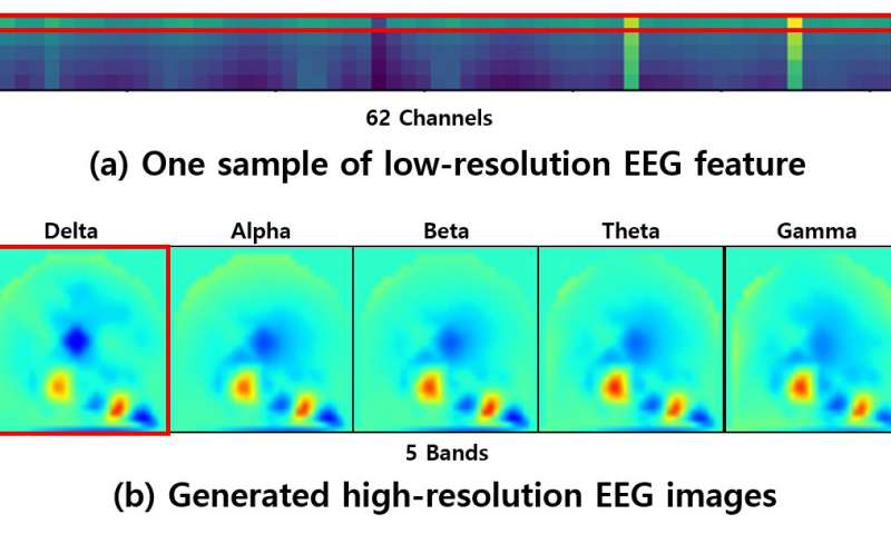 A new deep learning model for EEG-based emotion recognition