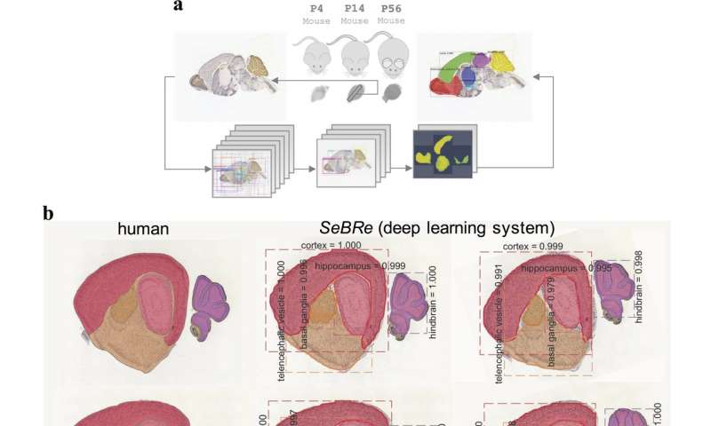 Developing brain atlas using deep learning algorithms