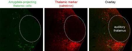 Exploring the role of cells in the lateral thalamus in controlling fear behavior