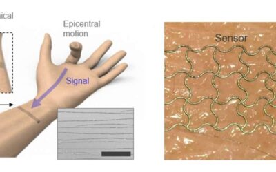 A deep-learning-enhanced e-skin that can decode complex human motions