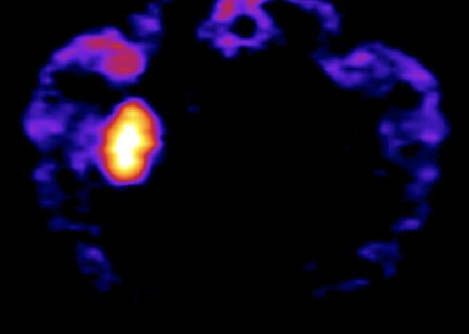 Researchers develop a selective chemogenetic actuator to rapidly control neuronal activity and behavior
