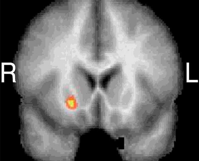 Exploring prediction errors that can influence human perceptions of time