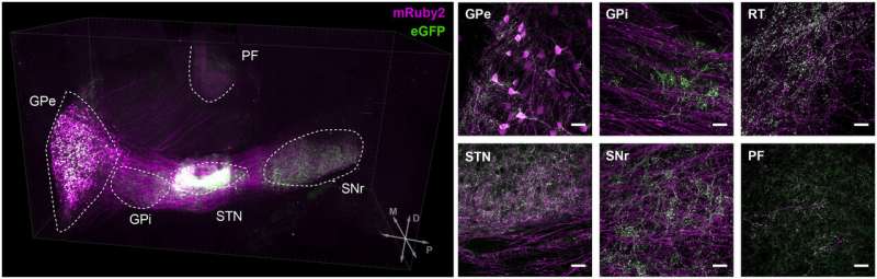 Study identifies two neuronal populations associated with symptoms of Parkinson’s disease