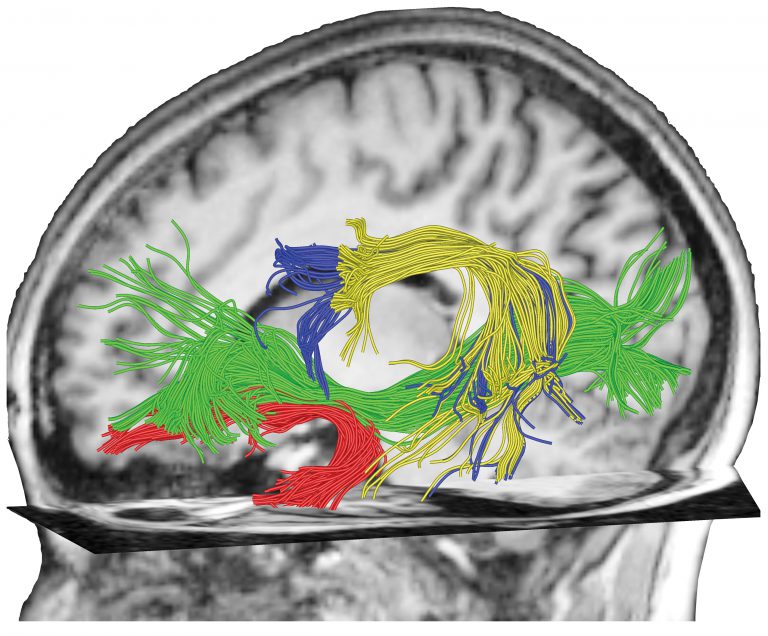 Professor Angela Friederici – The Neurobiology of the Human Language System