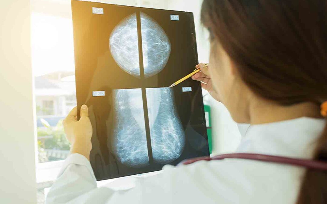 How statistics could inform breast cancer genetics research