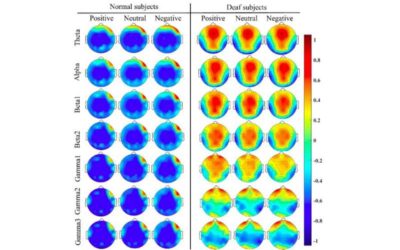 New model recognizes emotions in deaf individuals by analyzing EEG signals