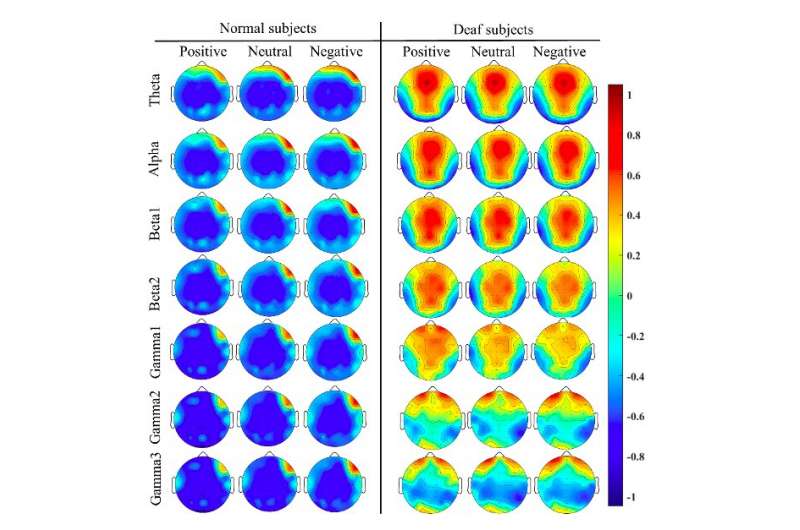 New model recognizes emotions in deaf individuals by analyzing EEG signals