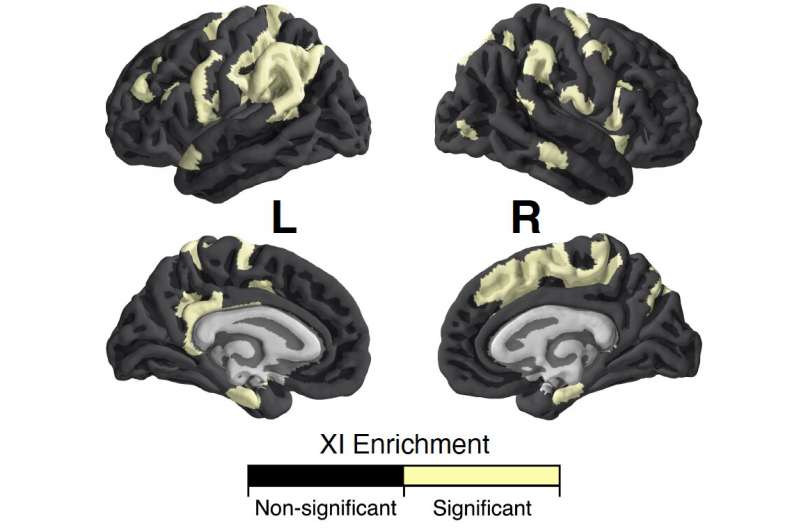 Study explores the influence of the X-chromosome on brain anatomy
