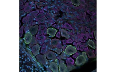 Using single-cell mass cytometry to explore the somatosensory system’s development