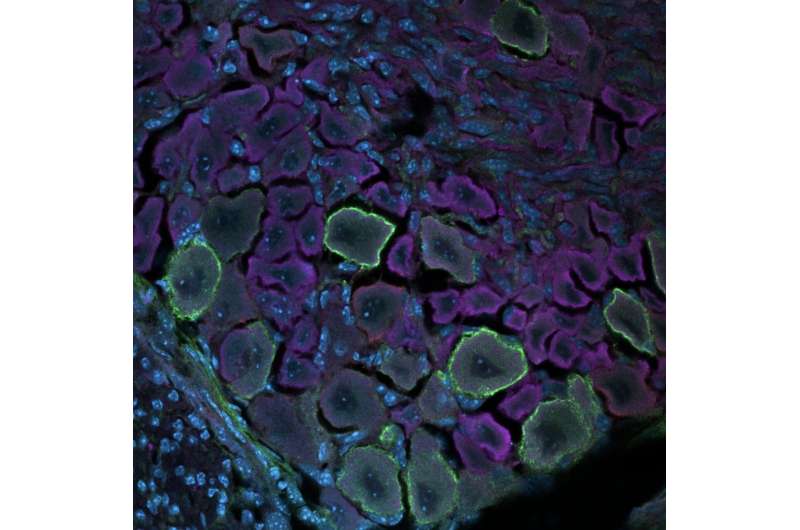 Using single-cell mass cytometry to explore the somatosensory system’s development