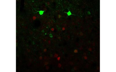 Study shows that ketamine switches neuronal activity in the neocortex