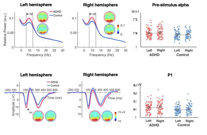 A single dose of methylphenidate does not affect the contextual visual perception of children with ADHD, shows study
