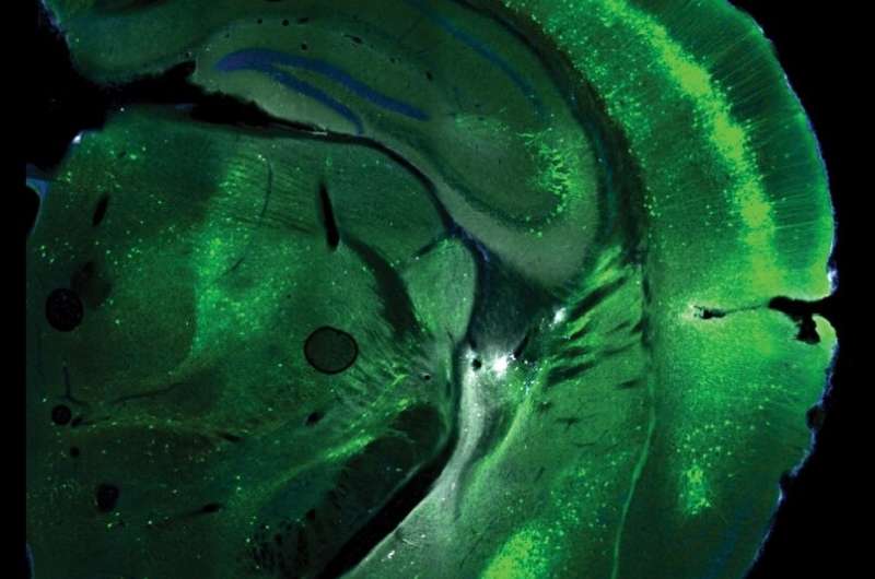 Study shows that distinct pyramidal cell types drive different patterns of cortical activity during decision-making