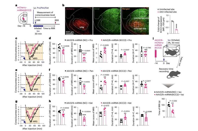 Study unveils neural processes underpinning the re-emergence of consciousness after anesthesia