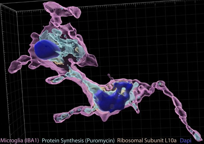 Study shows that the translation of protein by microglia supports efficient phagocytosis