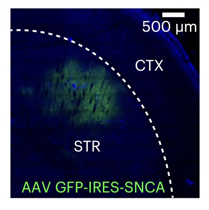 Study finds that the release of endocannabinoids is mediated by postsynaptic synucleins