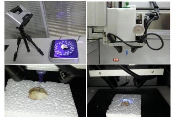 Review of recent progress in robotic printing of surgical implants promoting cartilage regeneration