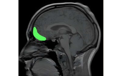 New findings show how the brain prepares to make choices during decision-making