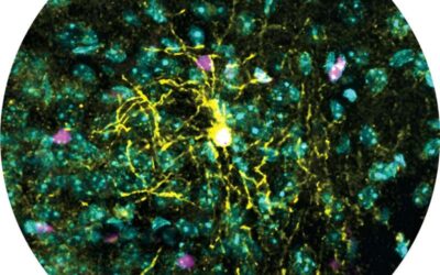 Study identifies sex differences in the brain cell types responding to stress