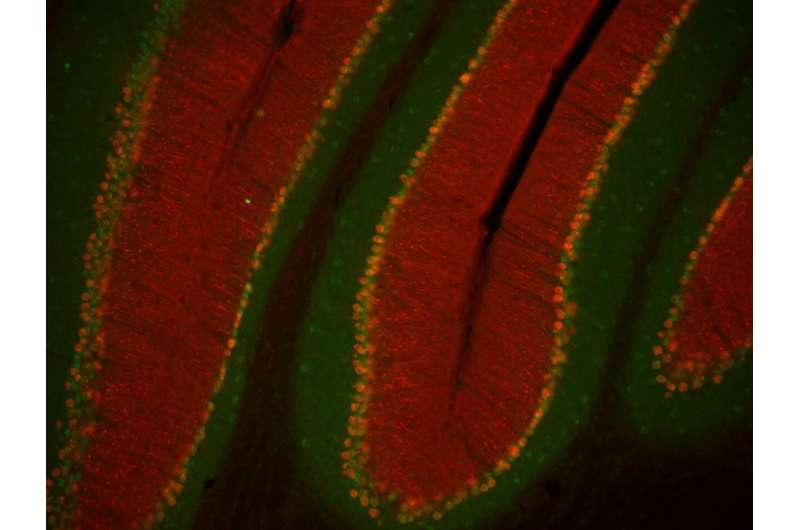 Study links associative learning in the cerebellum to movement control in mice
