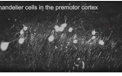 Study unveils an adaptive neural mechanism that supports robust and flexible learning