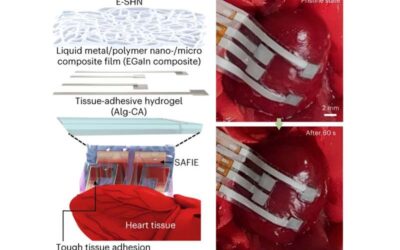 An adhesive and stretchable epicardial patch to precisely monitor the heart’s activity
