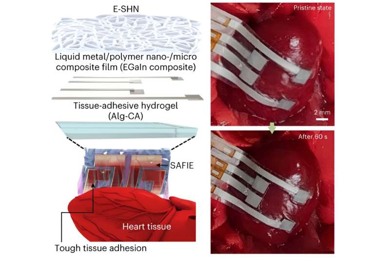 An adhesive and stretchable epicardial patch to precisely monitor the heart’s activity