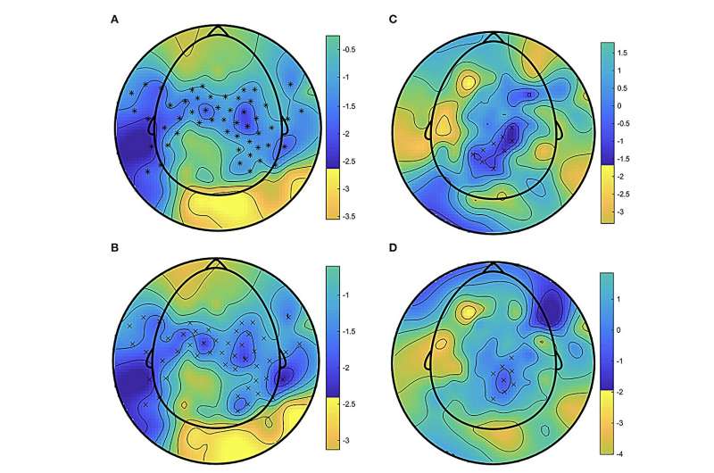 The neural underpinnings of surround sound and its effects on a listener’s sense of presence