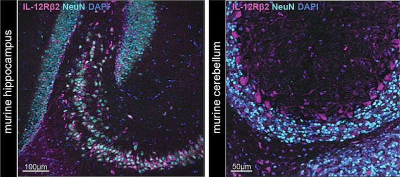 Neuronal sensing of cytokine IL-12 induces tissue adaptation and protects mice from neuroinflammation