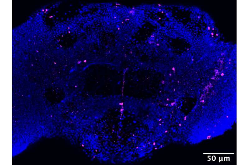 An immune molecule that regulates aging and a living organism’s lifespan