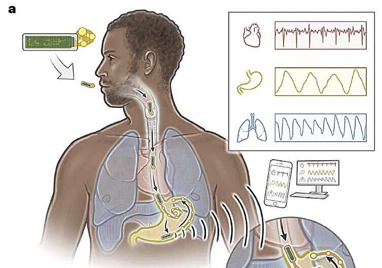 An ingestible device to record gastric electrophysiological activity