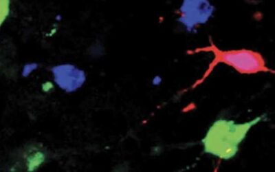 Study shows orexin neurons can track how fast blood glucose changes