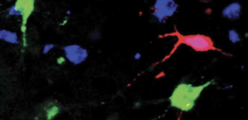 Study shows orexin neurons can track how fast blood glucose changes