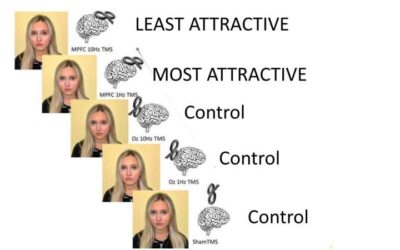 Stimulating the medial prefrontal cortex changes a person’s perceived attractiveness, study suggests