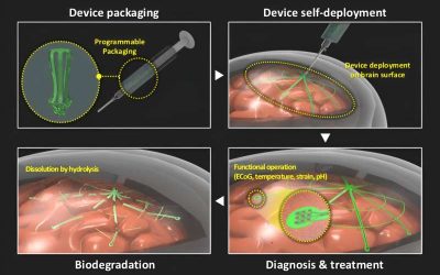 Self-deployable, biodegradable electrode offers minimally invasive brain signal monitoring