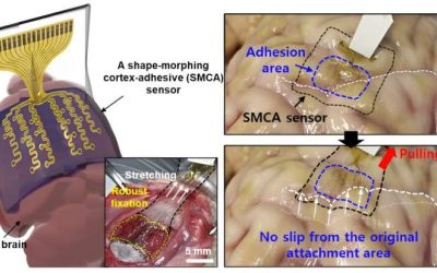 Shape-morphing brain sensor adheres to curved surfaces for ultrasound neurostimulation