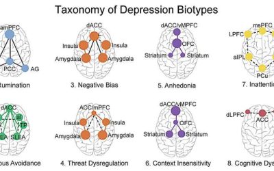 Transcranial magnetic stimulation shows promise for treatment-resistant depression biotype