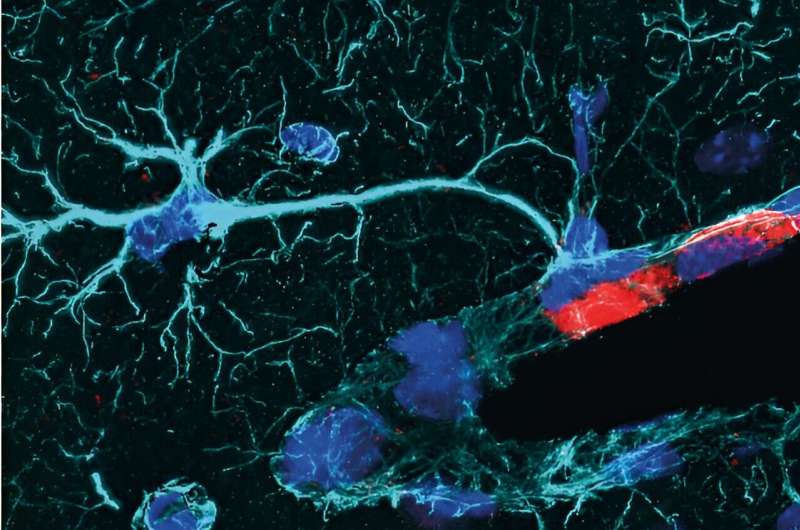 Central nervous system-associated macrophages could modulate post-stroke immune responses