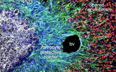 Exploring how astrocytes respond to spinal cord injury or stroke-induced tissue damage