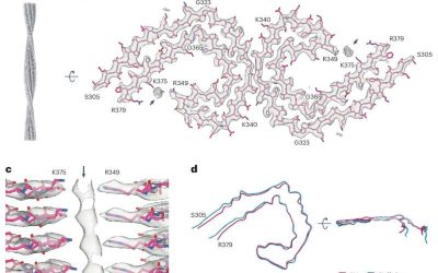 Study explores association between Tau filaments and extracellular vesicles in Alzheimer’s disease