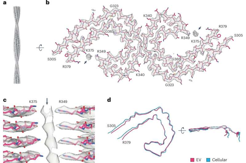 Study explores association between Tau filaments and extracellular vesicles in Alzheimer’s disease