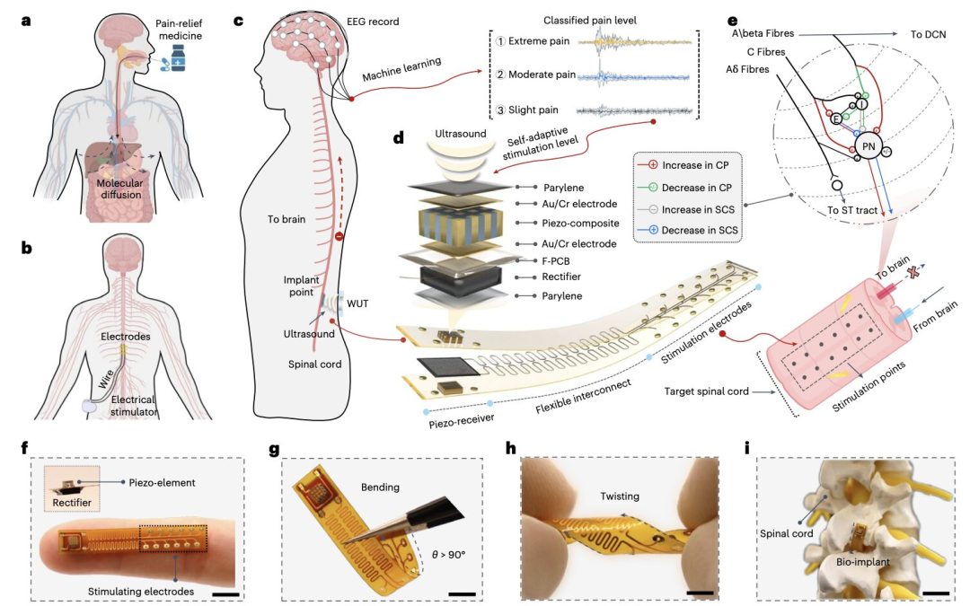 Flexible implant detects pain levels and delivers targeted electrical stimulation wirelessly