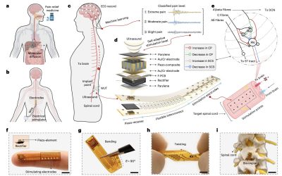 Flexible implant detects pain levels and delivers targeted electrical stimulation wirelessly