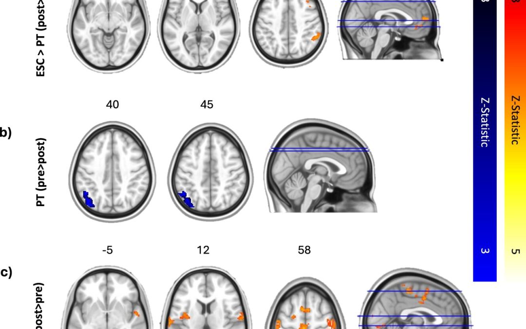 Psilocybin better preserves depressed patients’ emotional response to music than standard drug, study finds