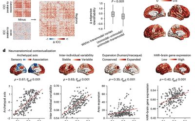 General anesthesia reduces uniqueness of brain’s functional ‘fingerprint,’ study finds
