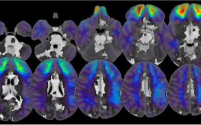 Study uncovers a brain circuit linked to the intensity of political behavior
