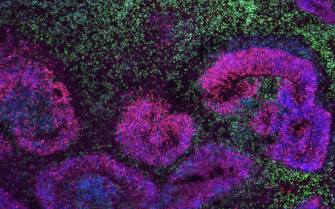 Study uncovers gene networks driving the development of distinct neuron subtypes in the human cerebral cortex
