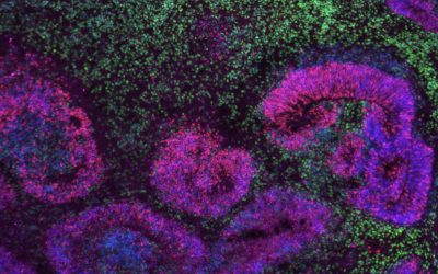 Study uncovers gene networks driving the development of distinct neuron subtypes in the human cerebral cortex