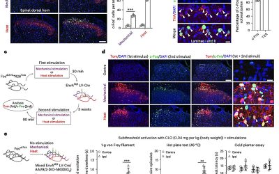 Neuron groups in mice spinal cord found responsible for encoding different types of pain