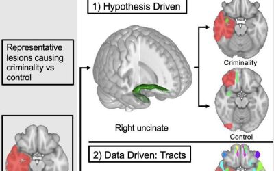 Injury to specific brain connections could explain some people’s criminal behavior, study finds